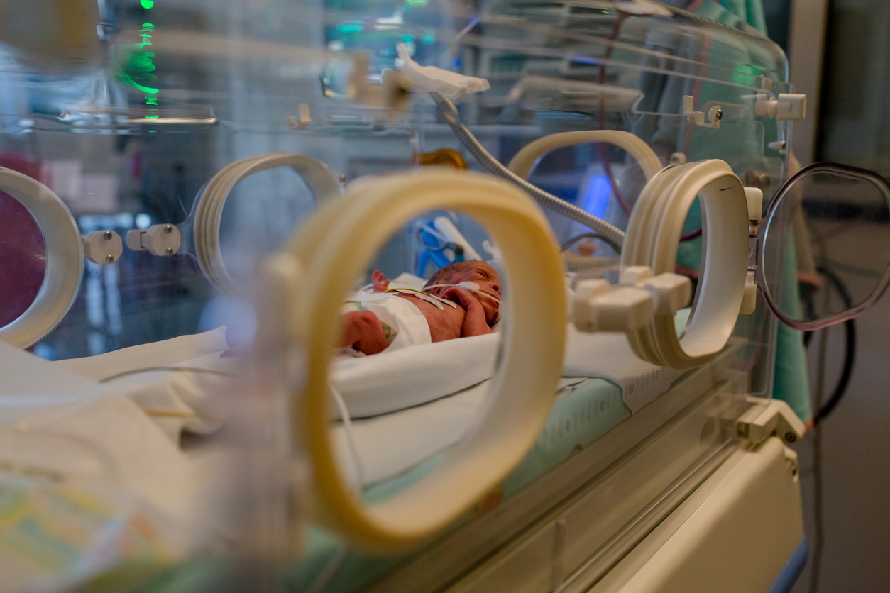 A wired premature baby lies in the incubator